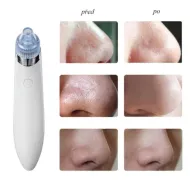 Vakuový čistič pleti - DermaSuction